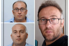 nimclinic-hair-transplant-before-after-turkey-14-400x400