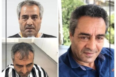 nimclinic-hair-transplant-before-after-turkey-3-400x400